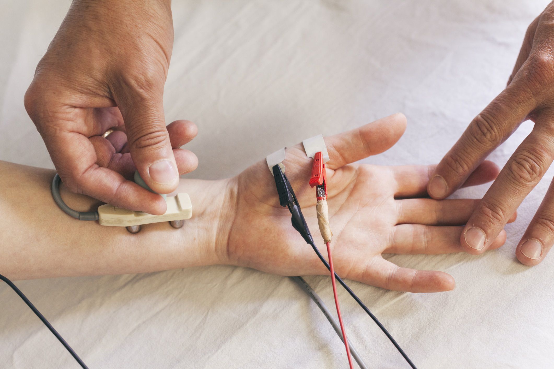 Nerve Conduction Velocity Test Kshetrapal Hospital